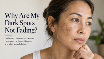 Why Are My Dark Spots Not Fading?