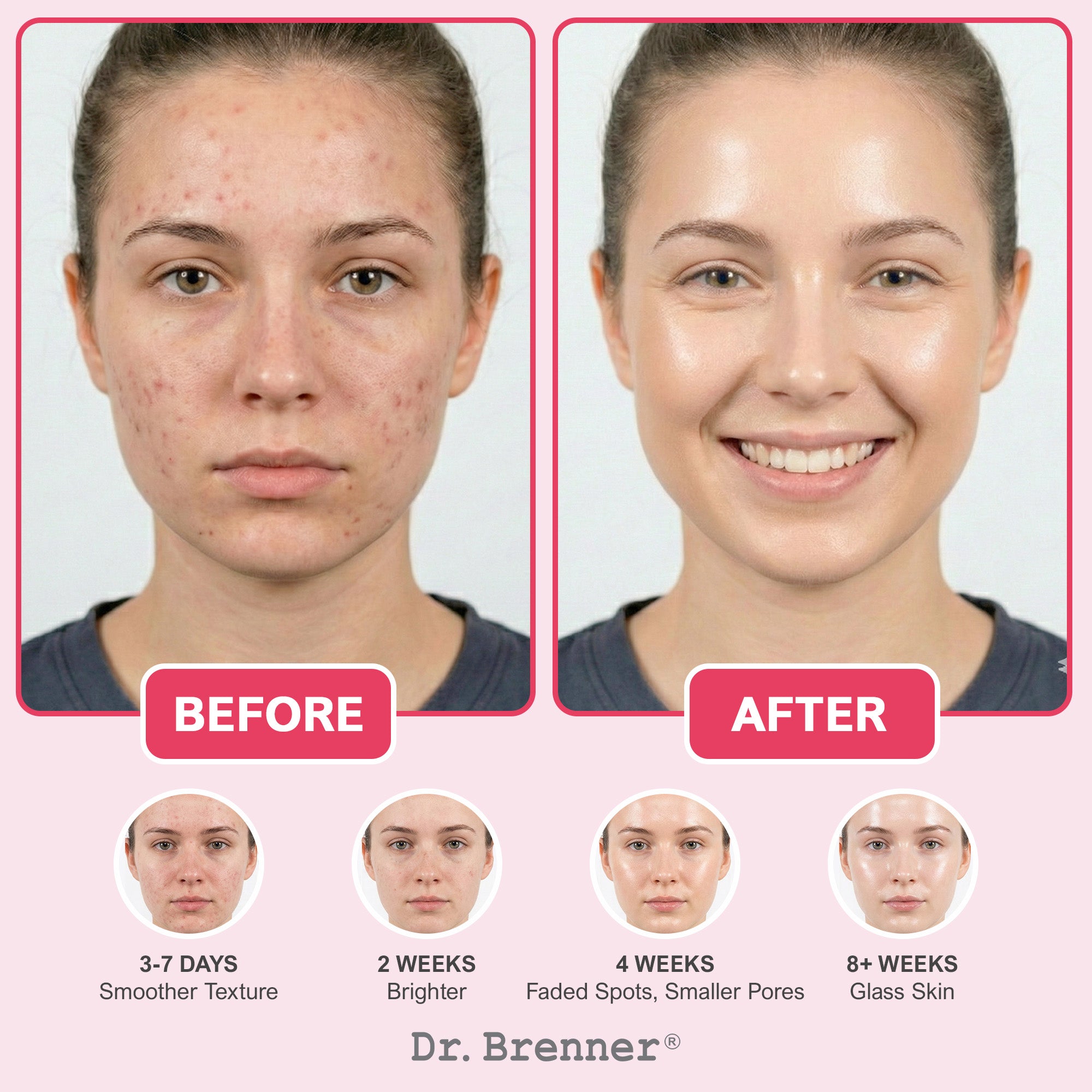 Niacinamide + TXA Serum – Dr. Brenner Labs